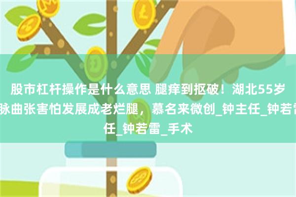 股市杠杆操作是什么意思 腿痒到抠破！湖北55岁大哥静脉曲张害怕发展成老烂腿，慕名来微创_钟主任_钟若雷_手术